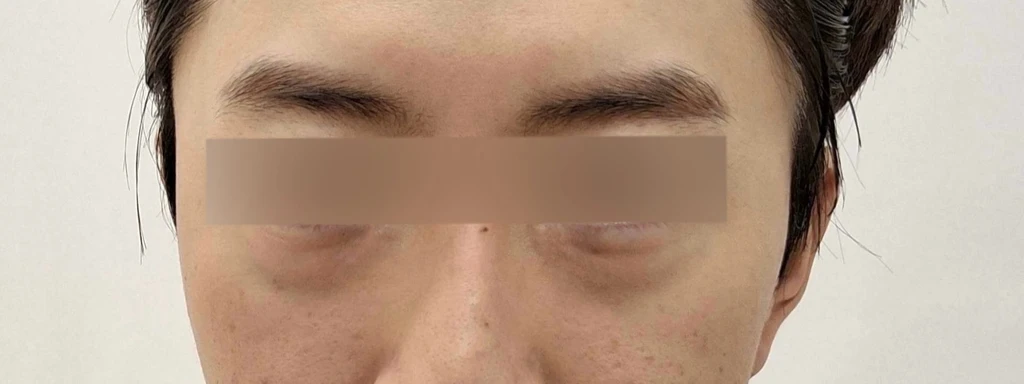 before_image