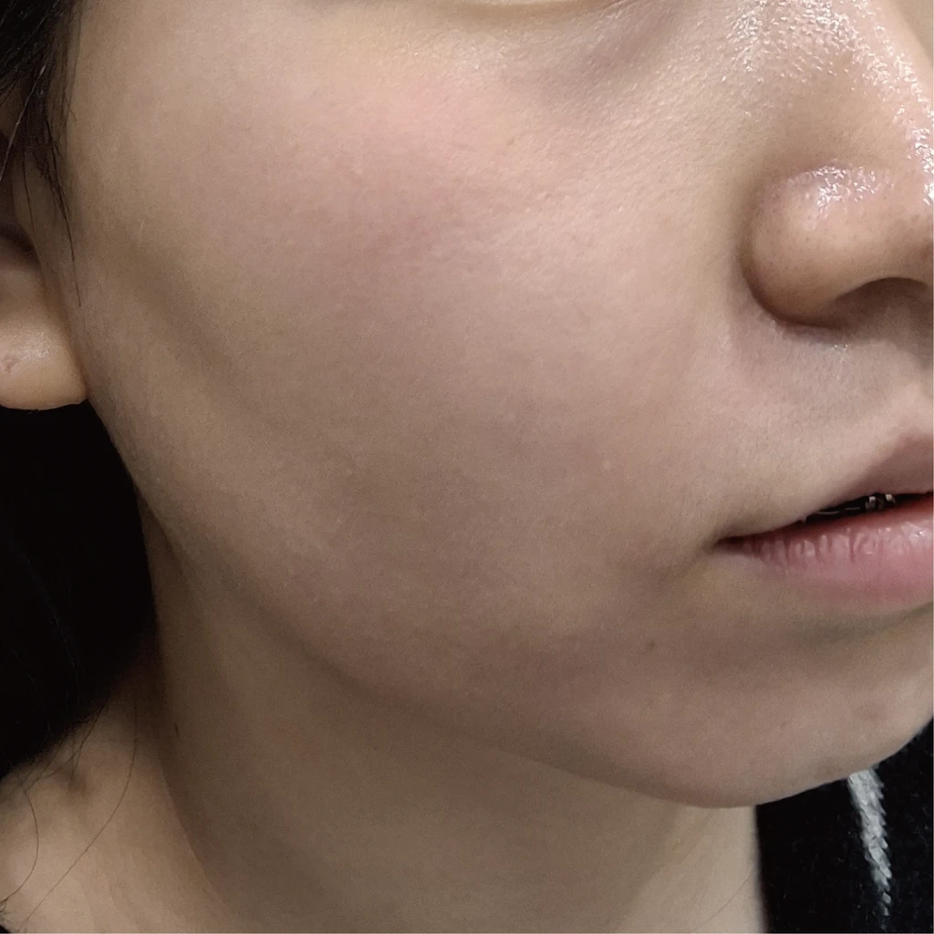 before_image