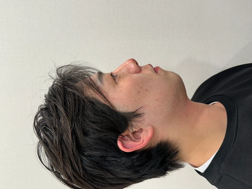 before_image