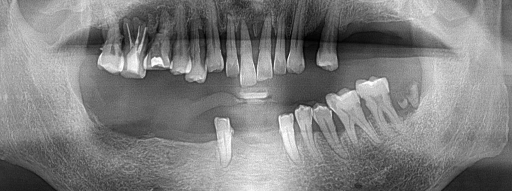before_image