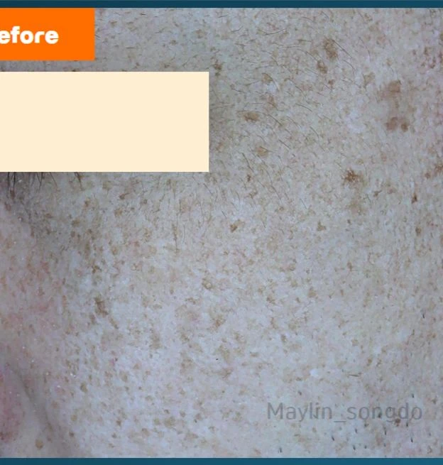 before_image