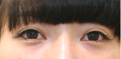 before_image