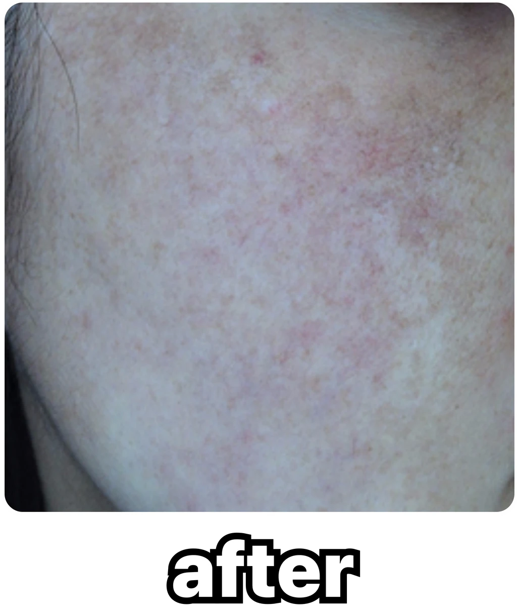 before_image