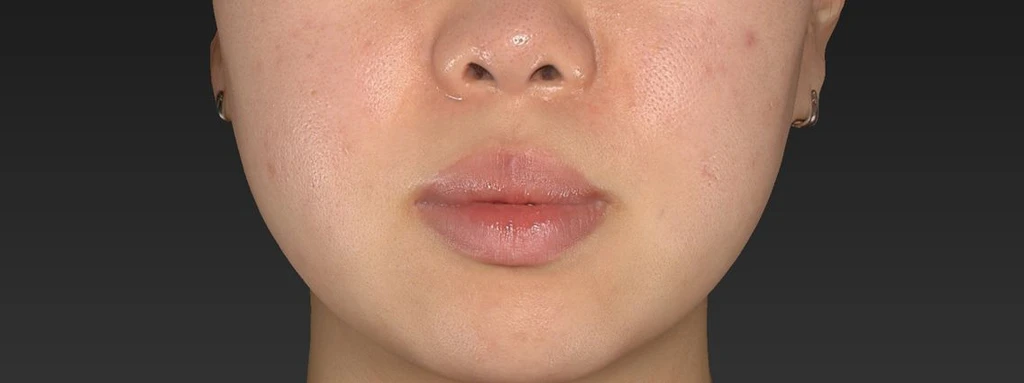 before_image