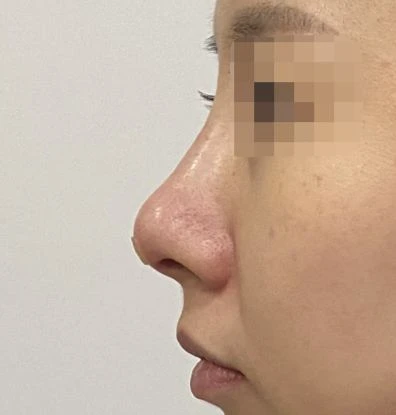 before_image