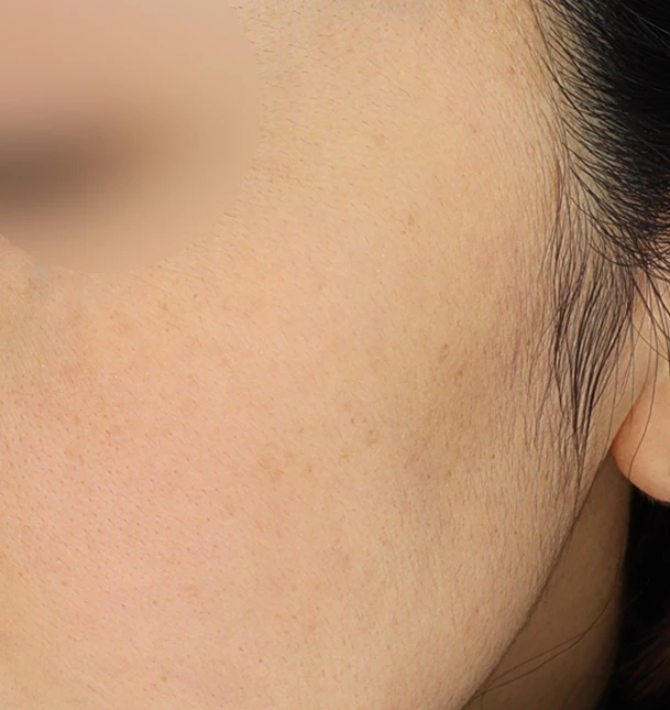 before_image