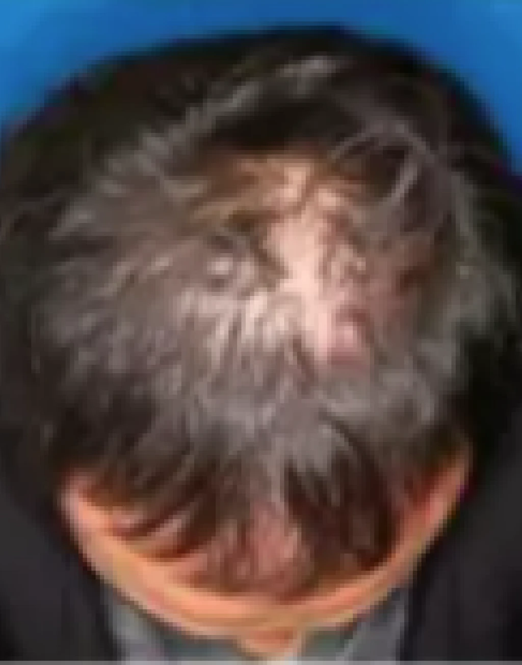 before_image