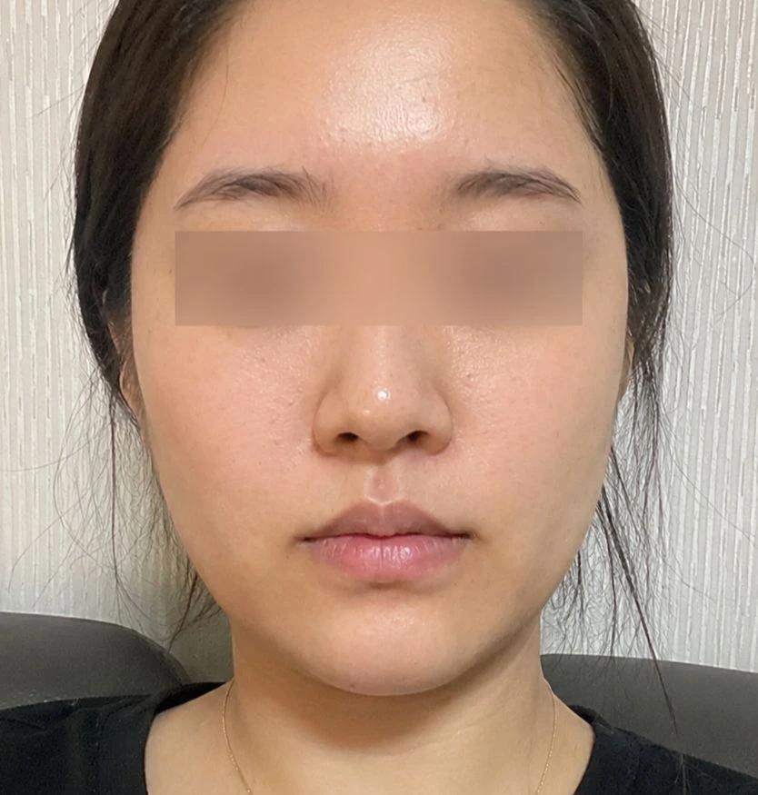 before_image