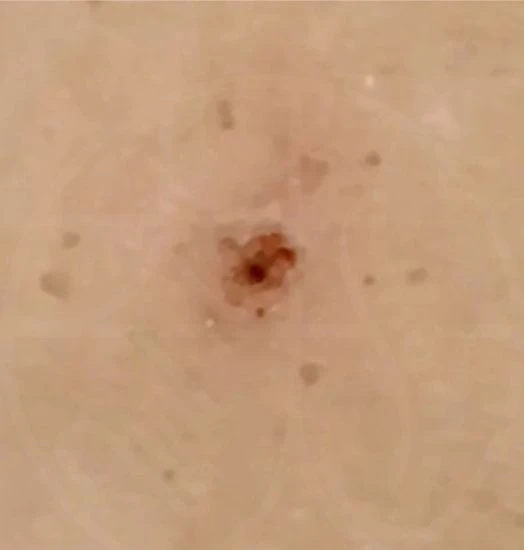 before_image
