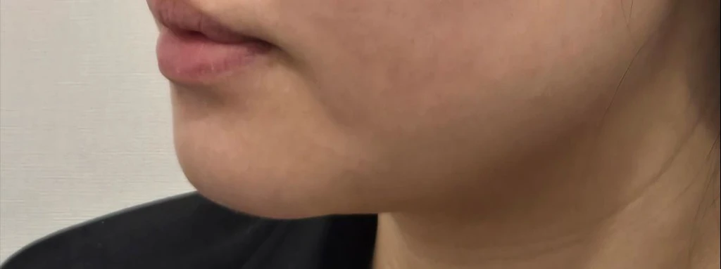 before_image