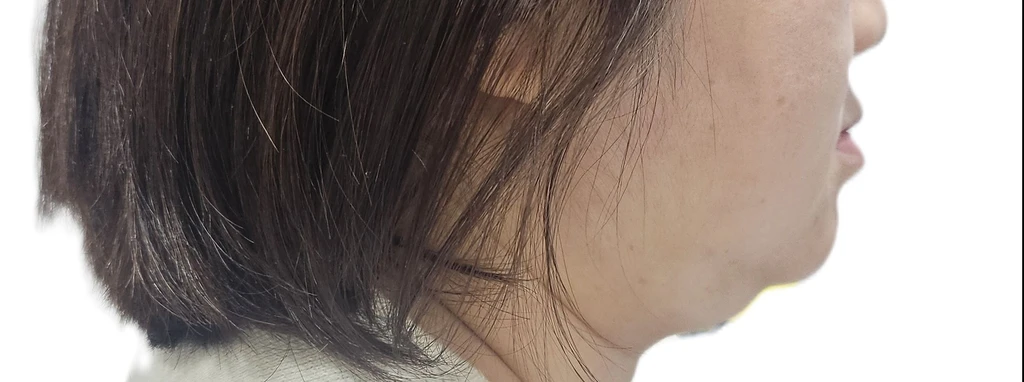 before_image