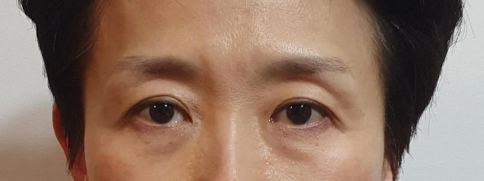 before_image