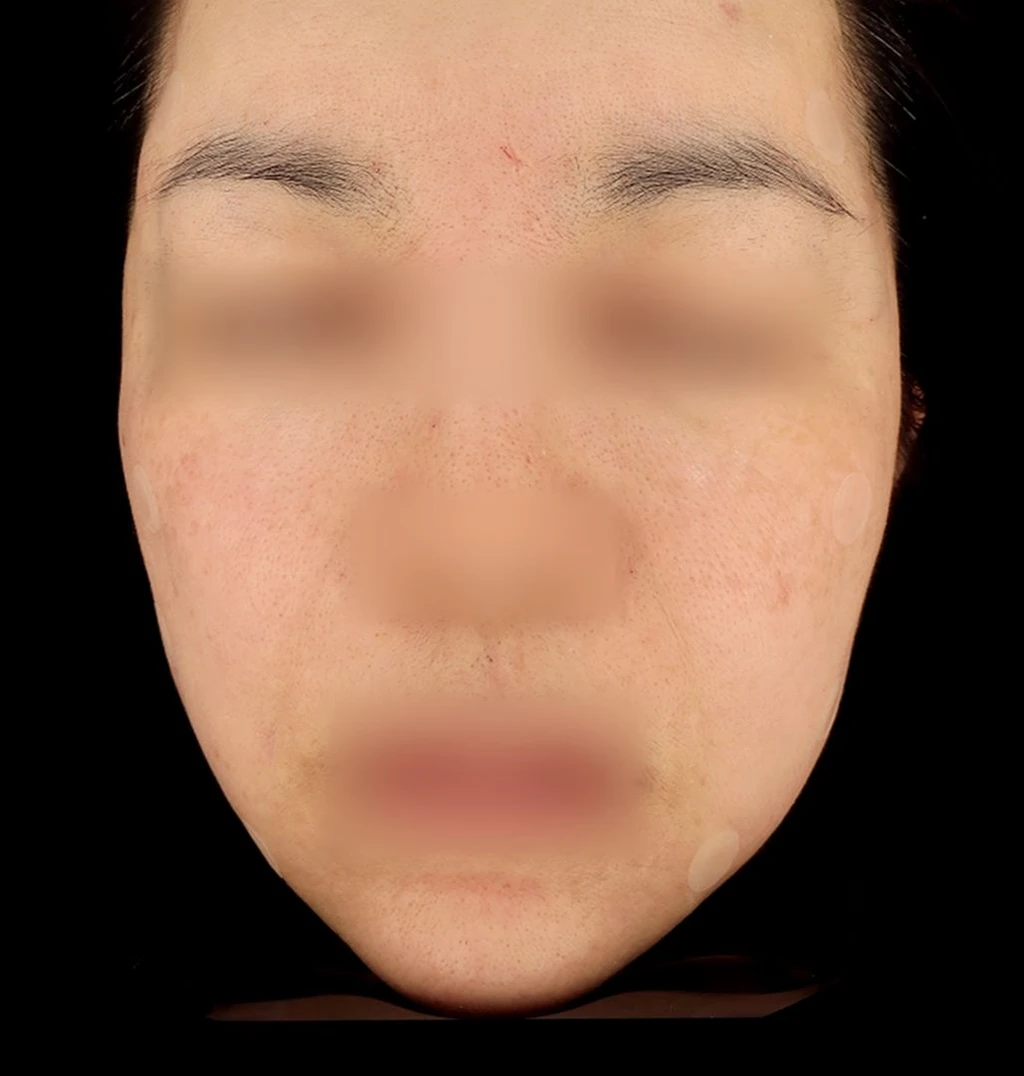 before_image