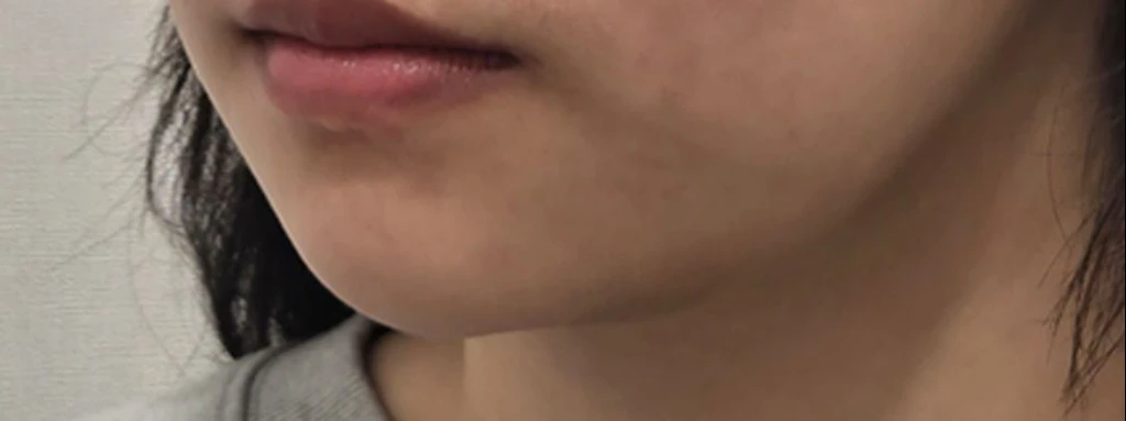 before_image
