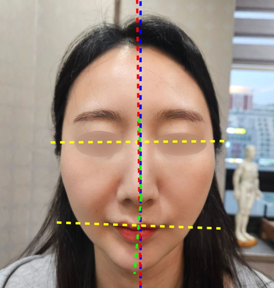 before_image