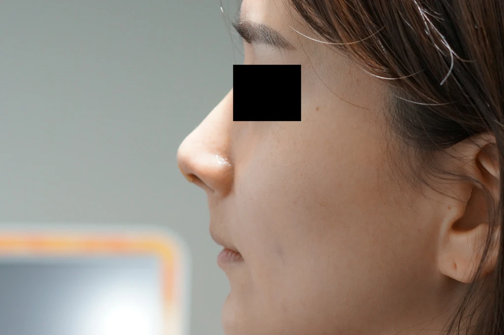 before_image