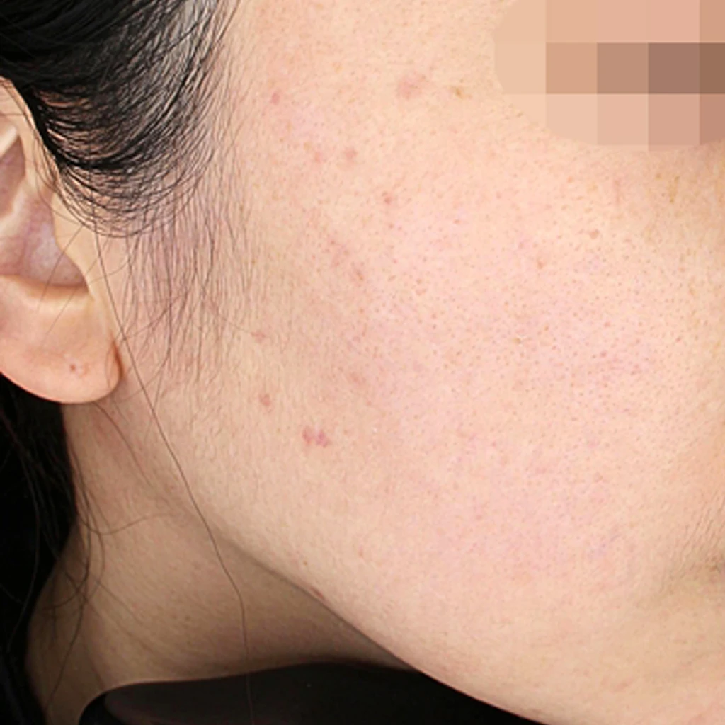 before_image