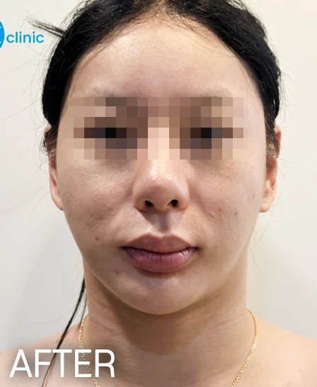 before_image