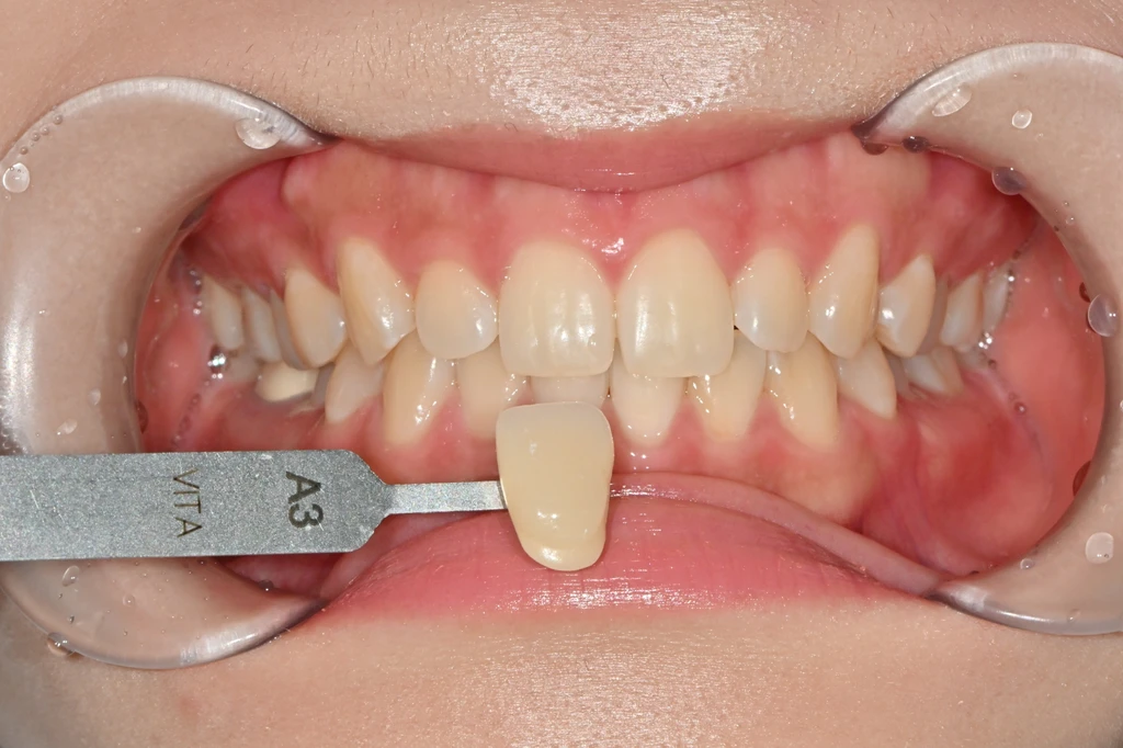 before_image