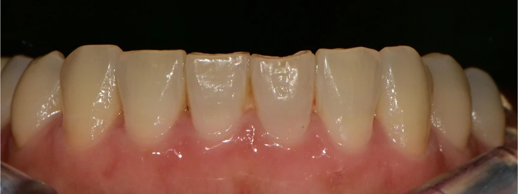 before_image