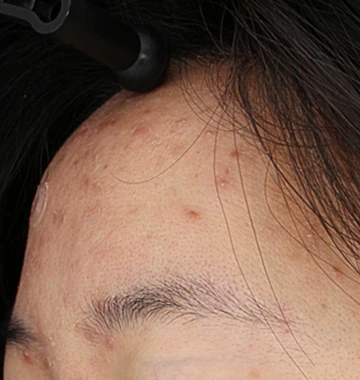 before_image