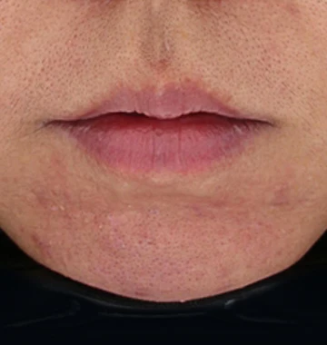 before_image