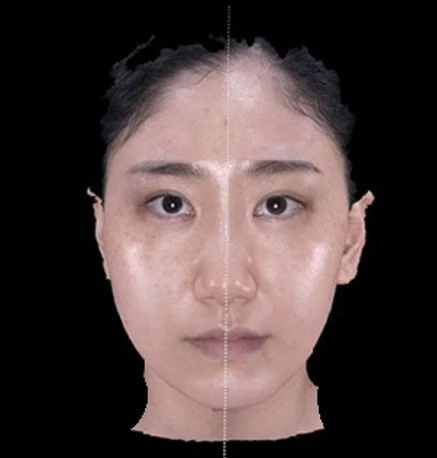 before_image