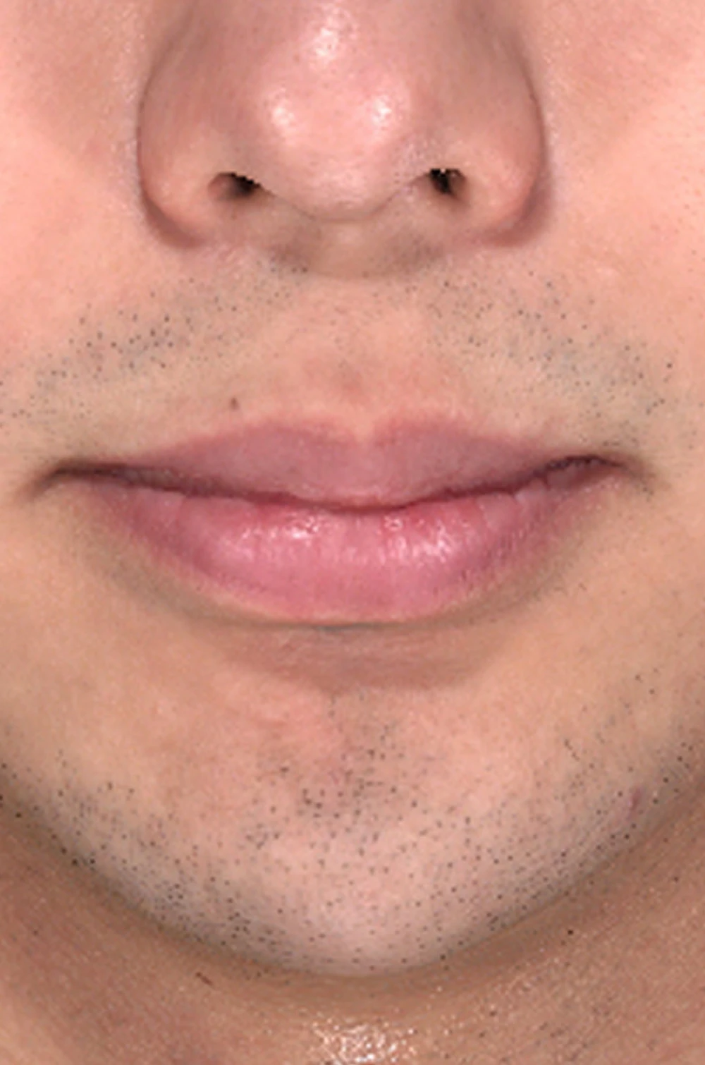 before_image