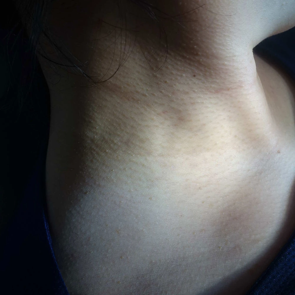 before_image