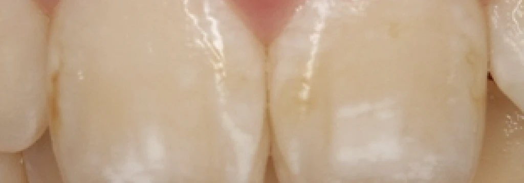 before_image