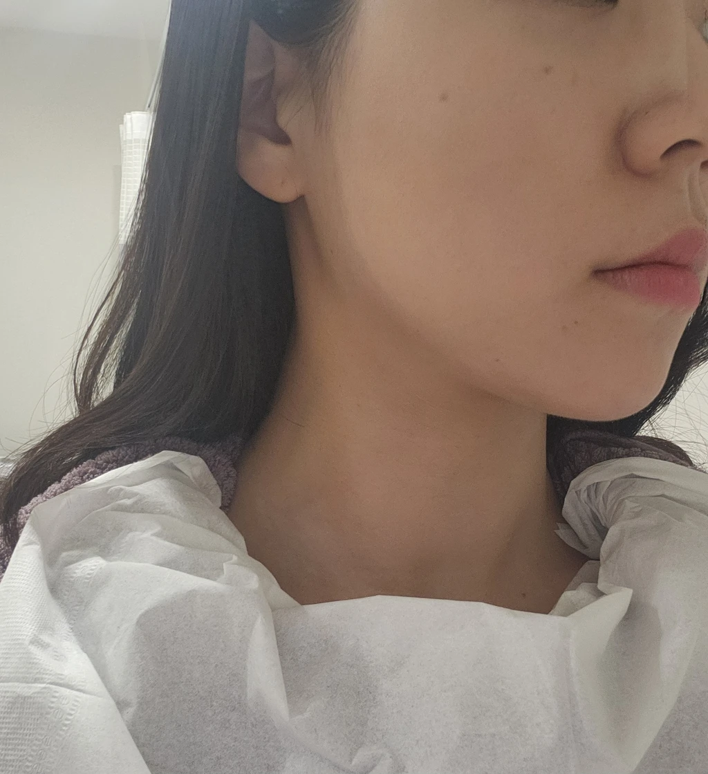before_image