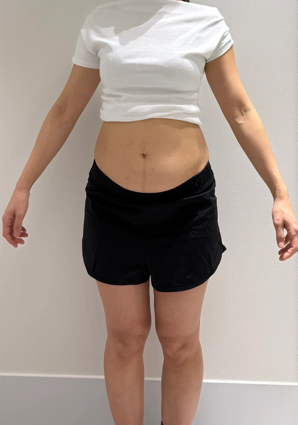 before_image