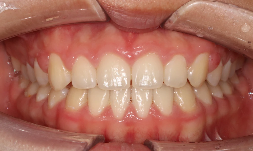 before_image