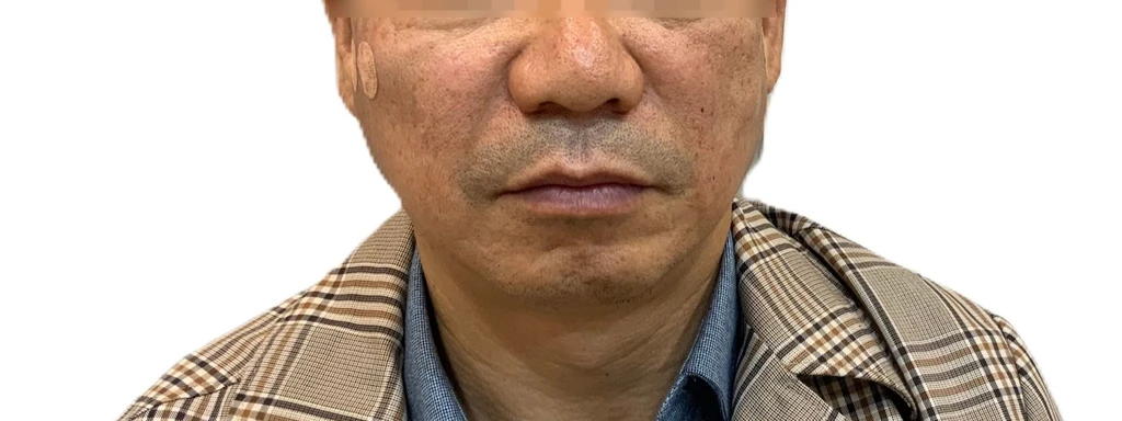 before_image