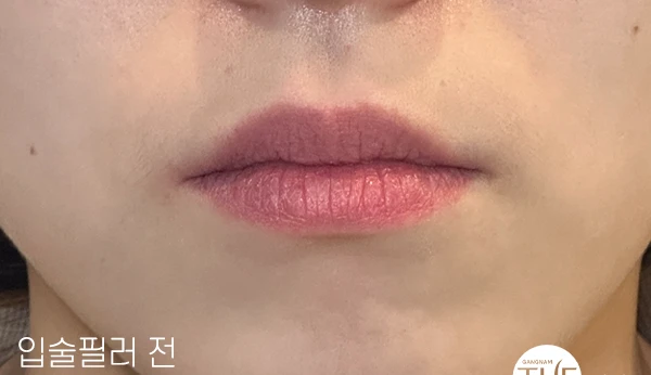 before_image