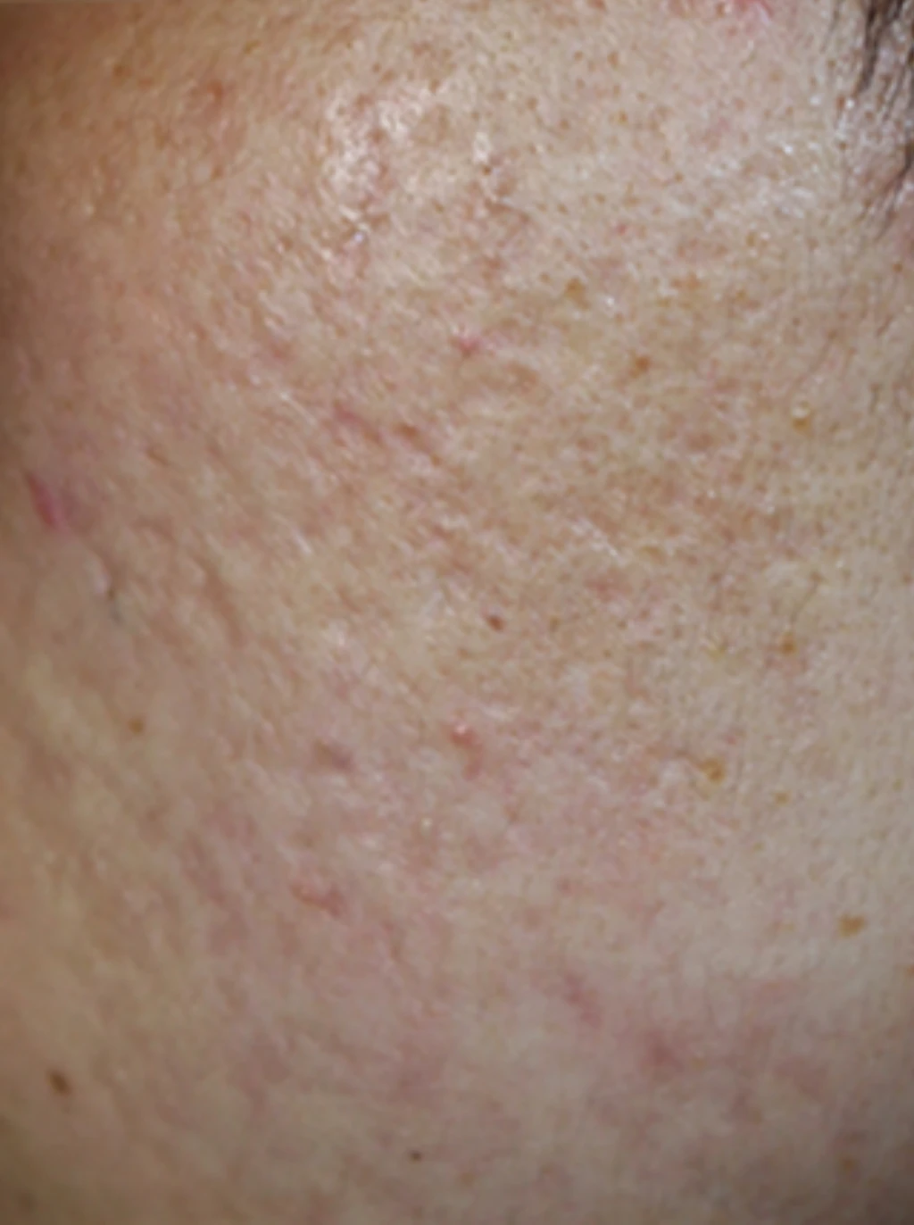 before_image