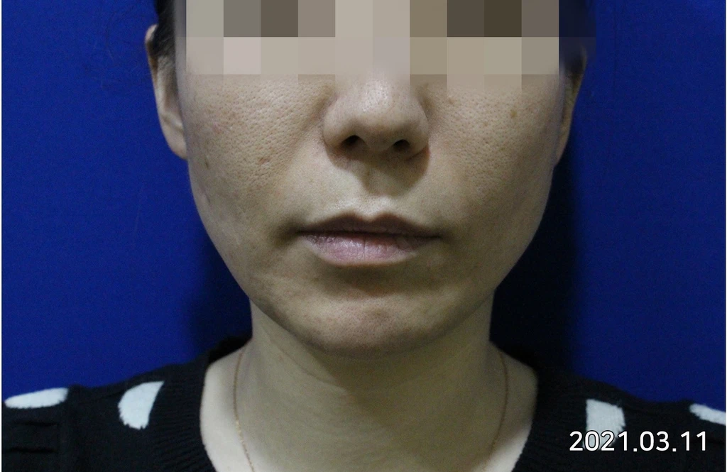 before_image
