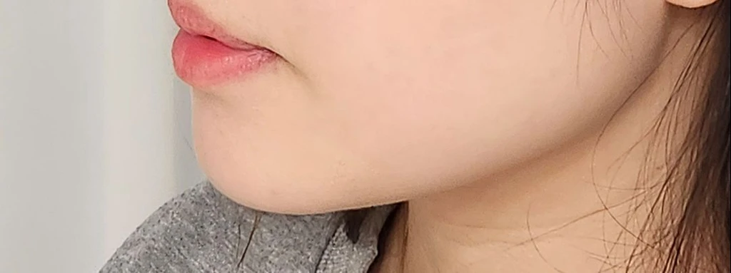 before_image