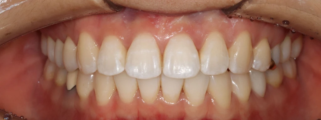 before_image