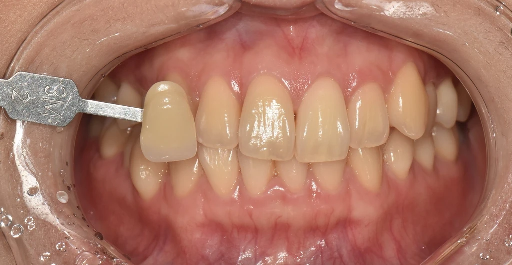 before_image