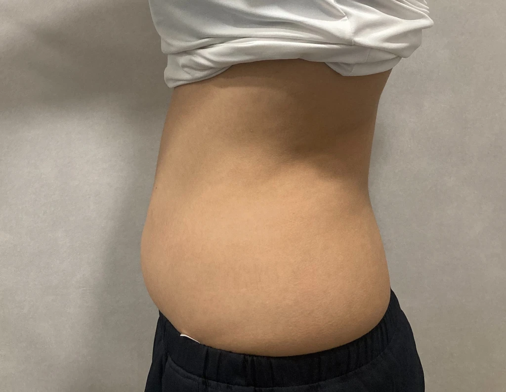before_image