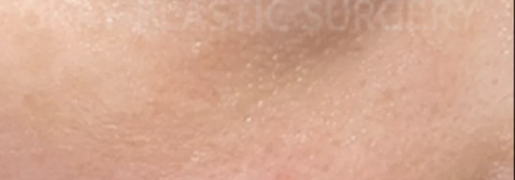 before_image