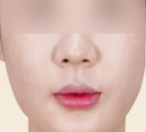 before_image