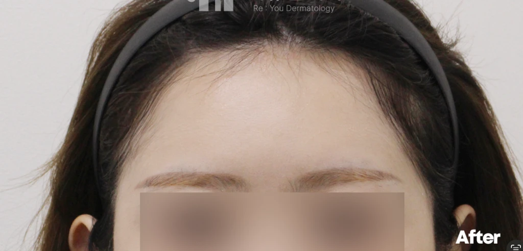 before_image