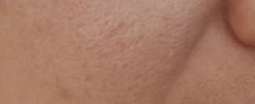before_image