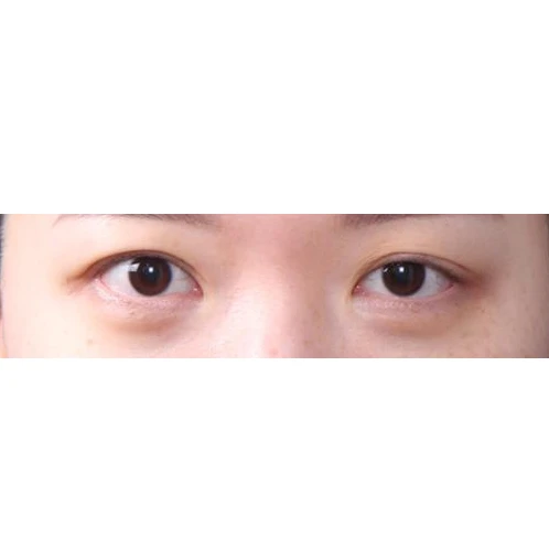 before_image