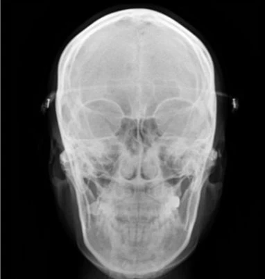 before_image