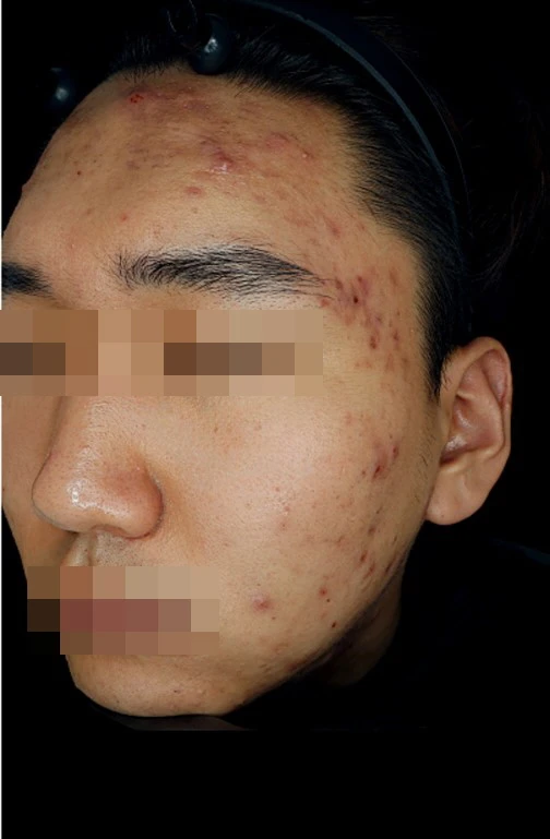 before_image