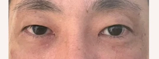 before_image