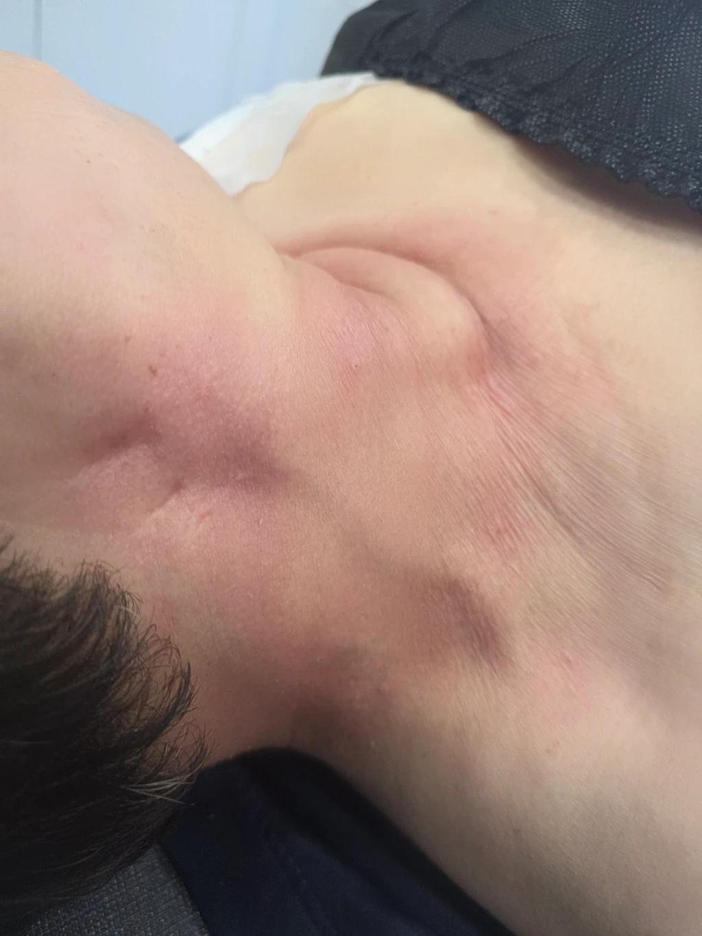 before_image